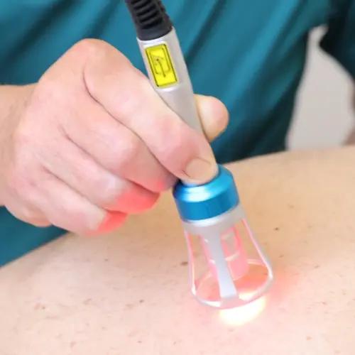 Terapevt uporablja lasersko terapijo za zdravljenje bolečin v hrbtu.